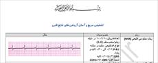 آموزش تفسیر نوار قلب (ECG)