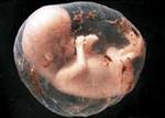 تحقیق-سقط-جنین