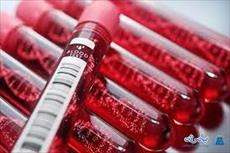 پاورپوینت اصول تضمين کيفيت در آزمايشگاه خون شناسی