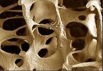 پاورپوینت-بیماریهای-متابولیک-استخوان