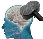 پاورپوینت-تحریک-الکتریکی-مغز