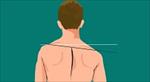 پاورپوینت-ناهنجاری-شانه-نابرابر-(uneven-shoulder)