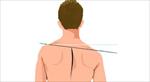 پاورپوینت-ناهنجاری-شانه-نابرابر-uneven-shoulder