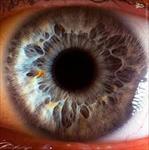 پاورپوینت-جراحی-های-چشم-و-بیماری-های-چشم