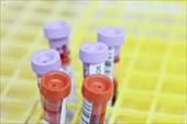 پاورپوینت درخواست منطقی آزمایشات غدد درون ریز Rational Request of Endocrine tests