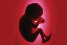 تحقیق بررسی احكام سقط جنین یا سقط حمل