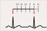 پاورپوینت-خصوصیات-امواج-قلبی-در-الکتروکاردیوگرام