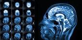 تحقیق مزایا و معایب استفاده از fMRI