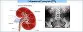 پاورپوینت IVP (Intravenous Pyelography)